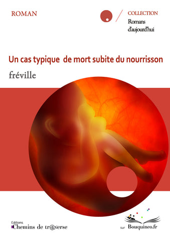 Un cas typique de mort subite du nourrisson - fréville